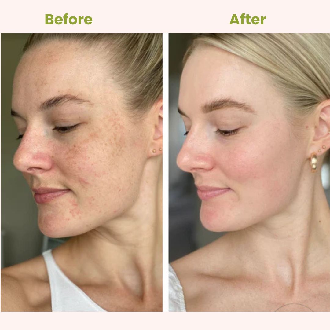 GLOW MAX-Brightening Cream