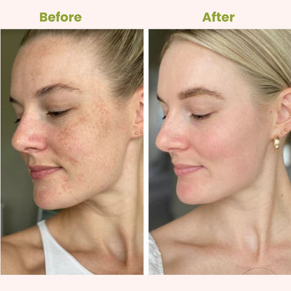 GLOW MAX-Brightening Cream